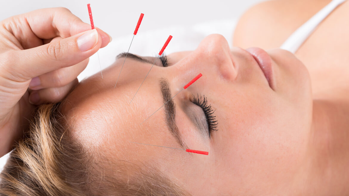 Acupuncture In Bedford
